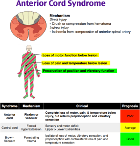 Anterior cord syndrome