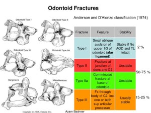 Upper c-spine fracture classification