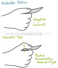 Adductor_pollicis.jpg