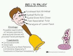 Facial nerve anatomy — central versus peripheral innervation