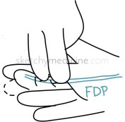 FDP.jpg