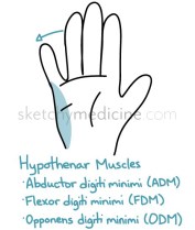hypothenar.jpg