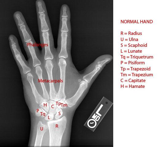 normal-hand-labeled2-143CAB906C6681C5612.jpg
