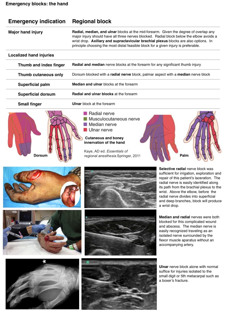 Forearm nerve block guide