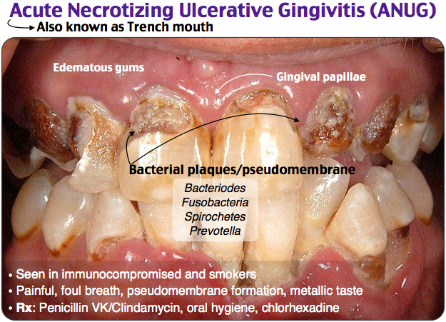Dental Problems MDM Dental Problems MDM