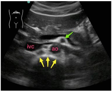 clockmantle-transverse-radiology-clinical-aliem-original.png