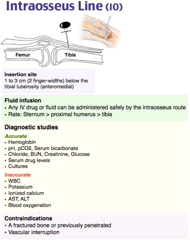 content_image_-_intraosseous_insertion_proximal_tibia_io_line.png