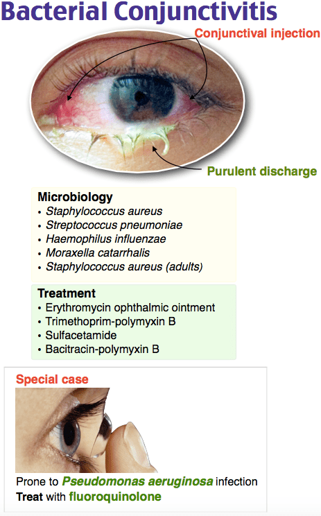 Bacterial conjunctivitis in contact lens wearer