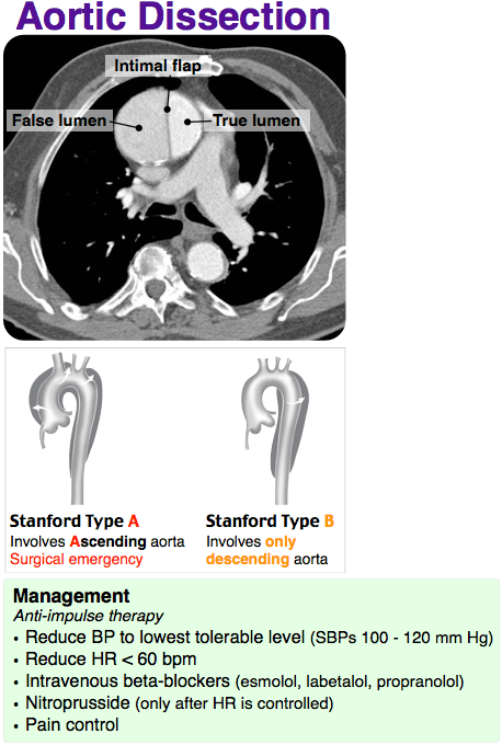 Aortic dissection management algorithm