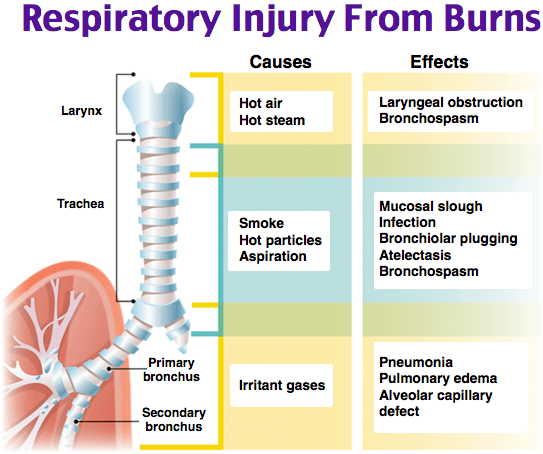 Respiratory injury from burns