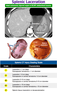 Splenic injury grading