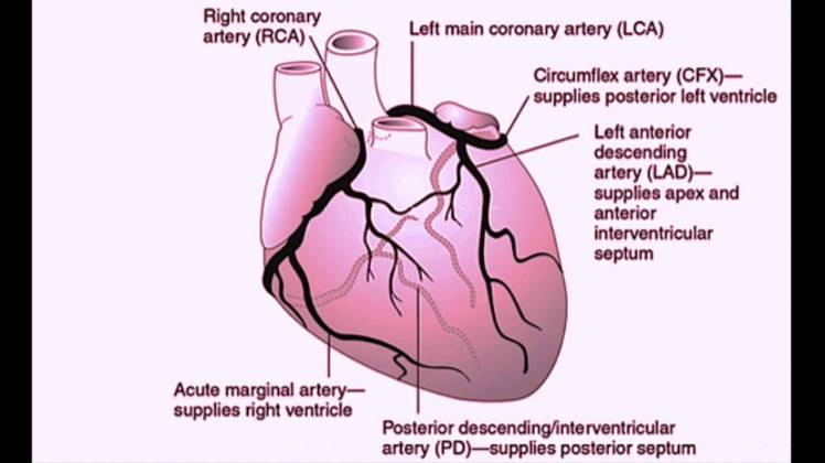 Posterior MI ECG comparison