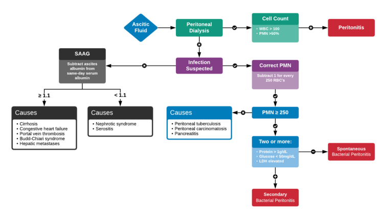 SBP and ascites evaluation algorithm